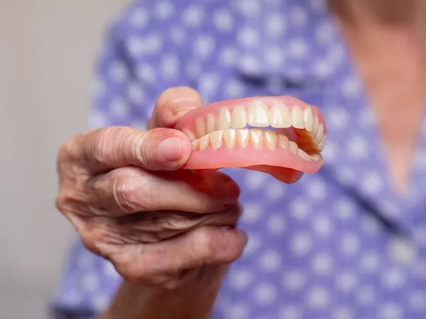 Implant-supported dentures