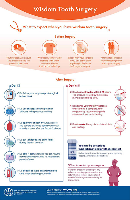 wisdom tooth surgery graphic